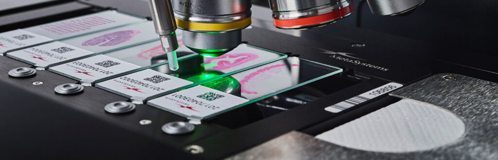 Automation With Metafer, even difficult imaging tasks can be easily automated.